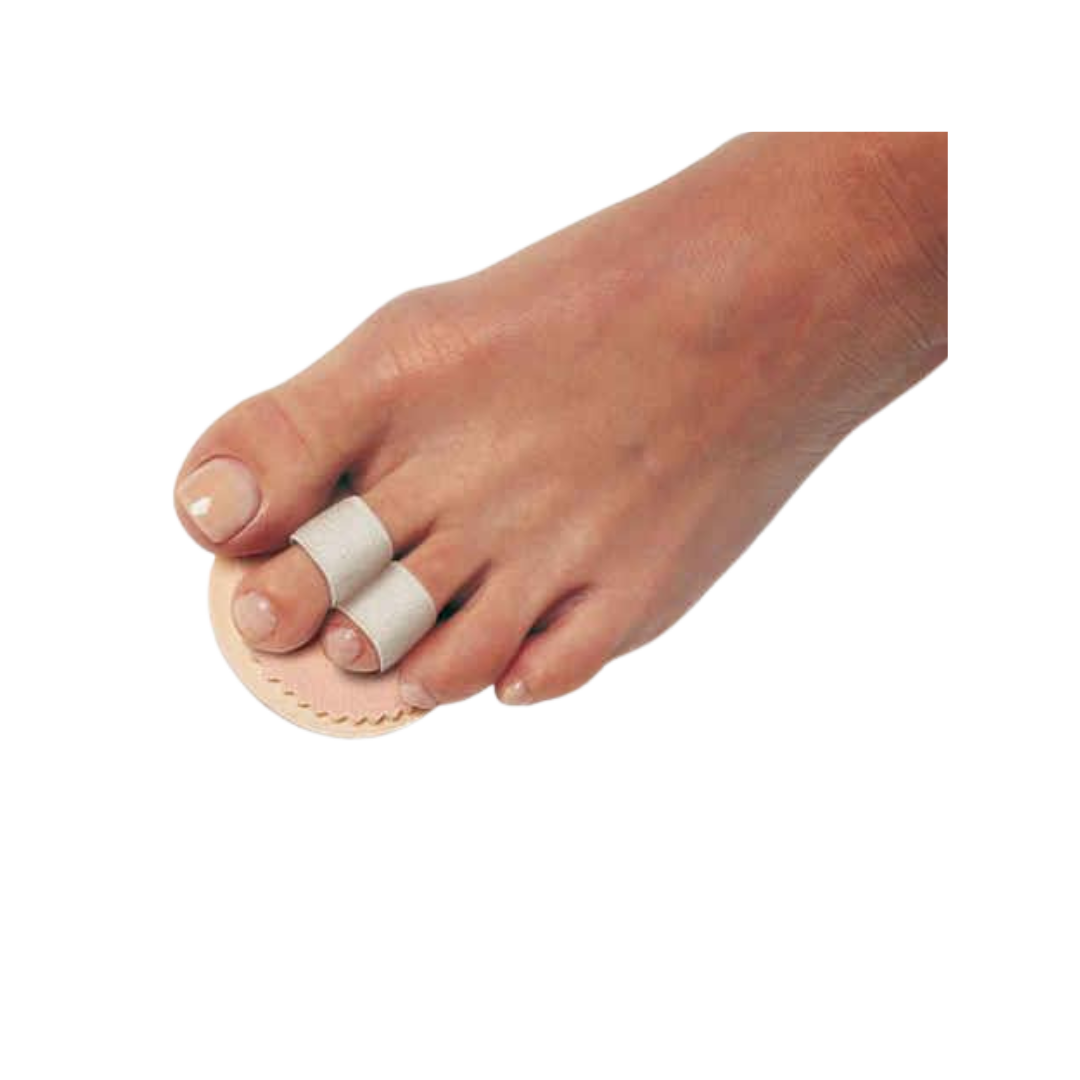 Double Loop Budin Splint – OrthoRx