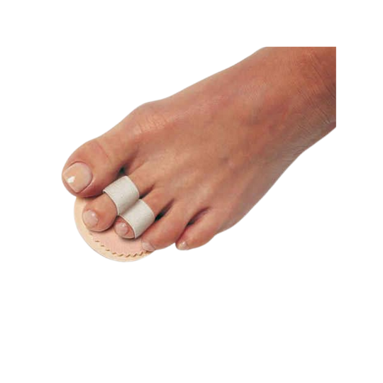 Double Loop Budin Splint